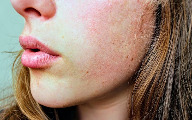 How to Figure Out Your Skin Type